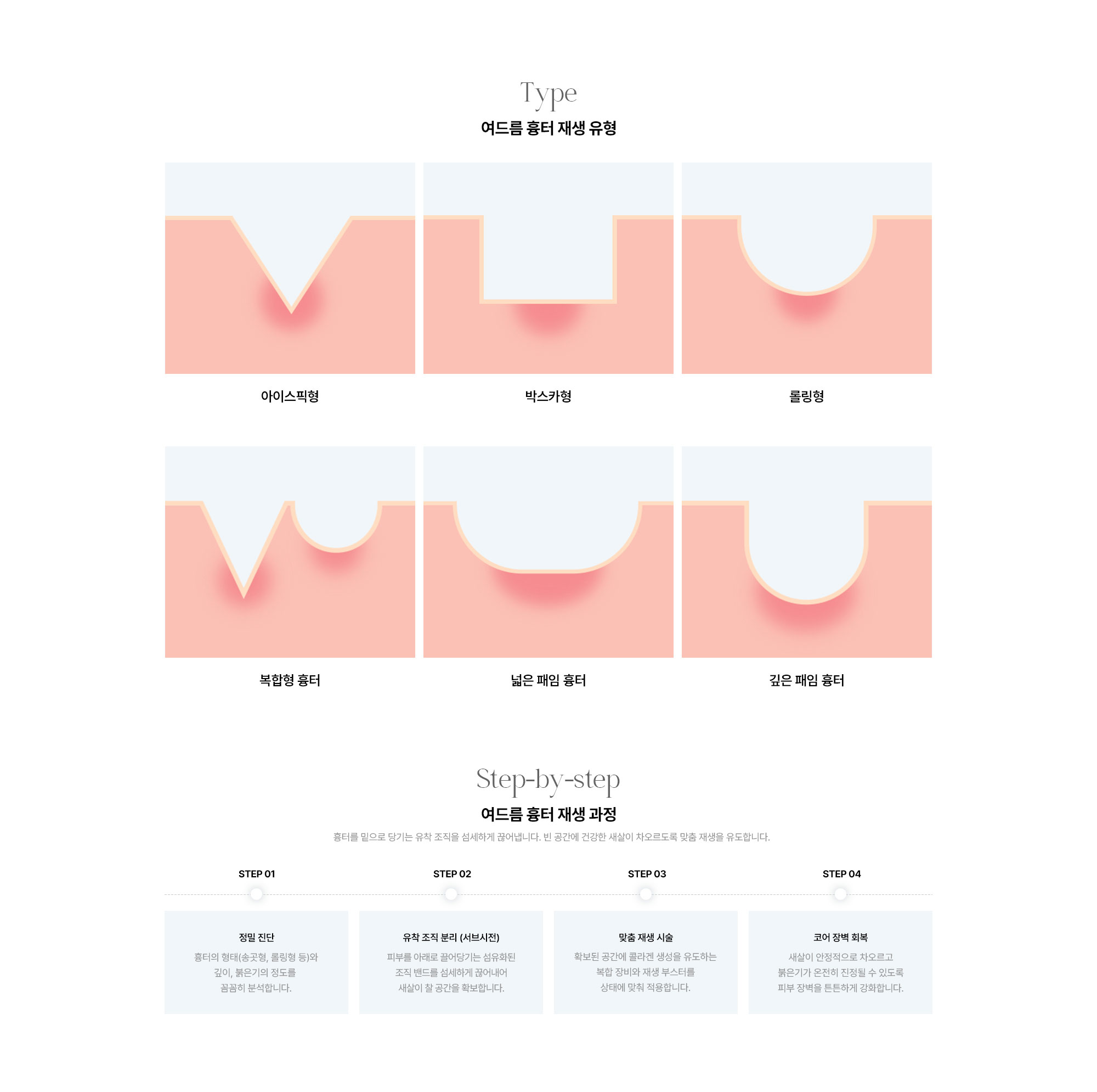 여드름 흉터 재생 과정 STEP01 정밀 진단 STEP02 유착 조직 분리 STEP03 맞춤 재생 시술 STEP04 코어 장벽 회복