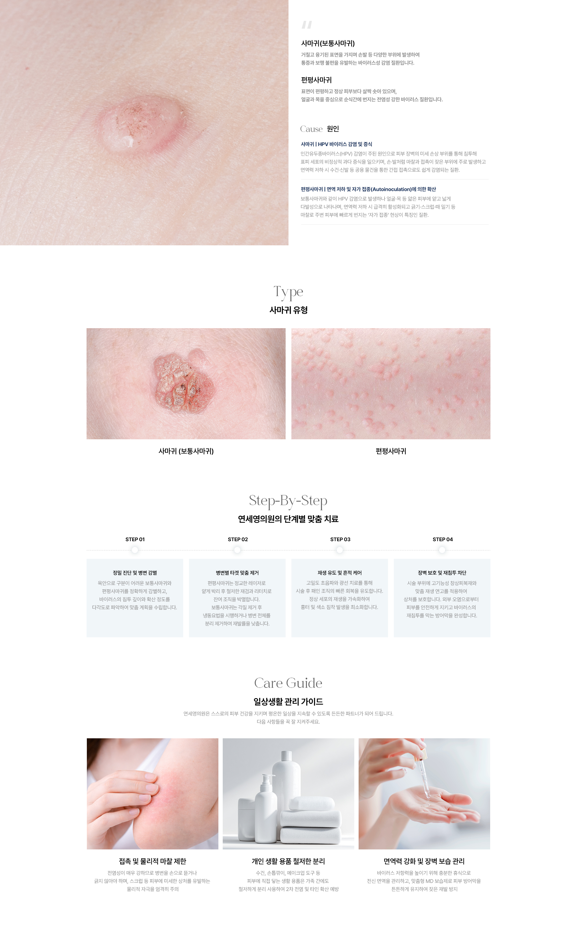 [사마귀(보통사마귀)] HPV 바이러스 감염·증식 · 손발 등 다양한 부위 바이러스성 감염 / [편평사마귀] 면역 저하·자가 접종에 의한 확산 · 얼굴·목 중심 전염성 강한 바이러스 질환