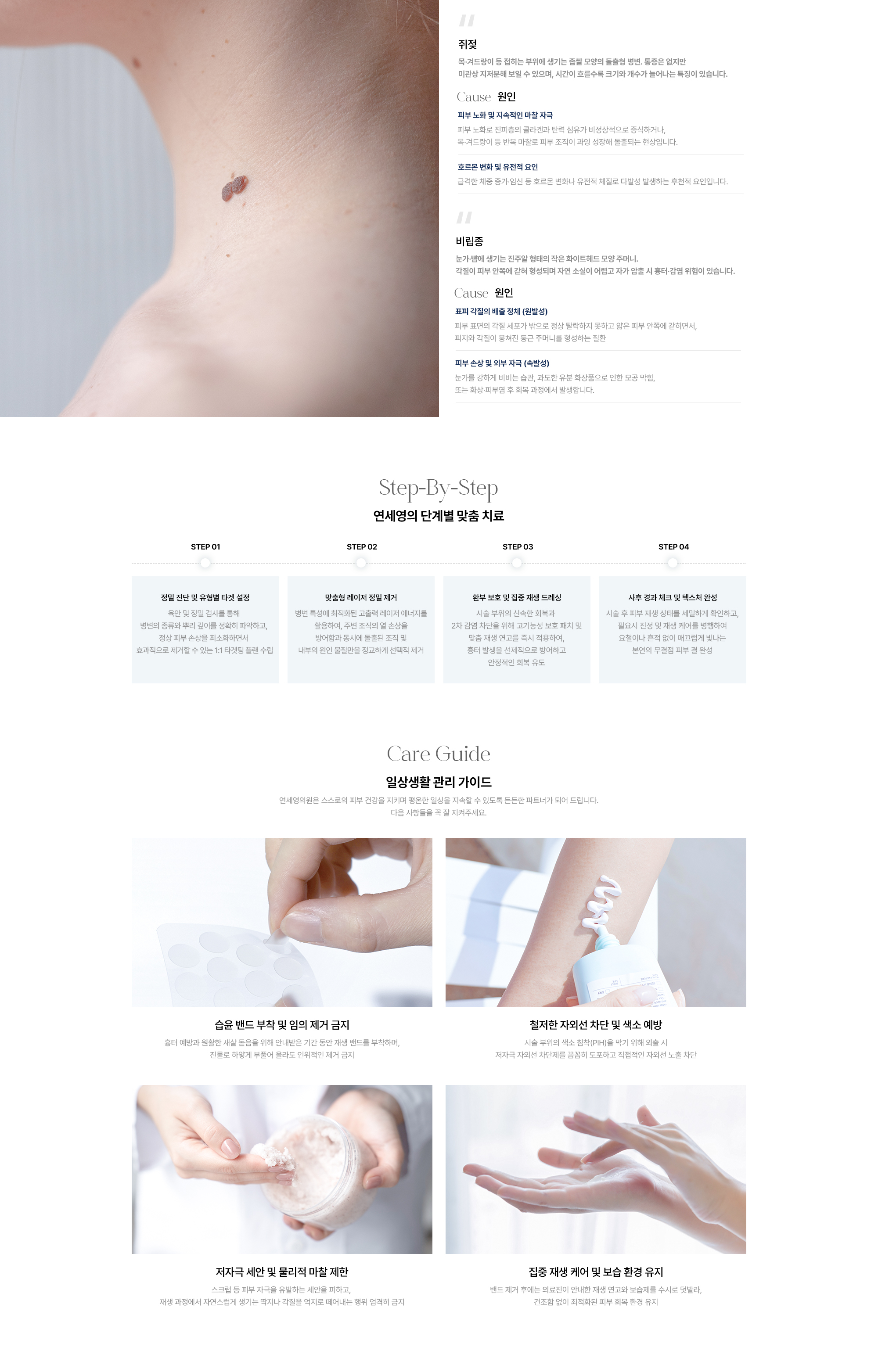 [쥐젖] 원인 : 피부 노화·지속적인 마찰 자극 · 호르몬 변화·유전적 요인 / [비립종] 원인 : 표피 각질의 배출 정체(원발성) · 피부 손상·외부 자극(속발성)